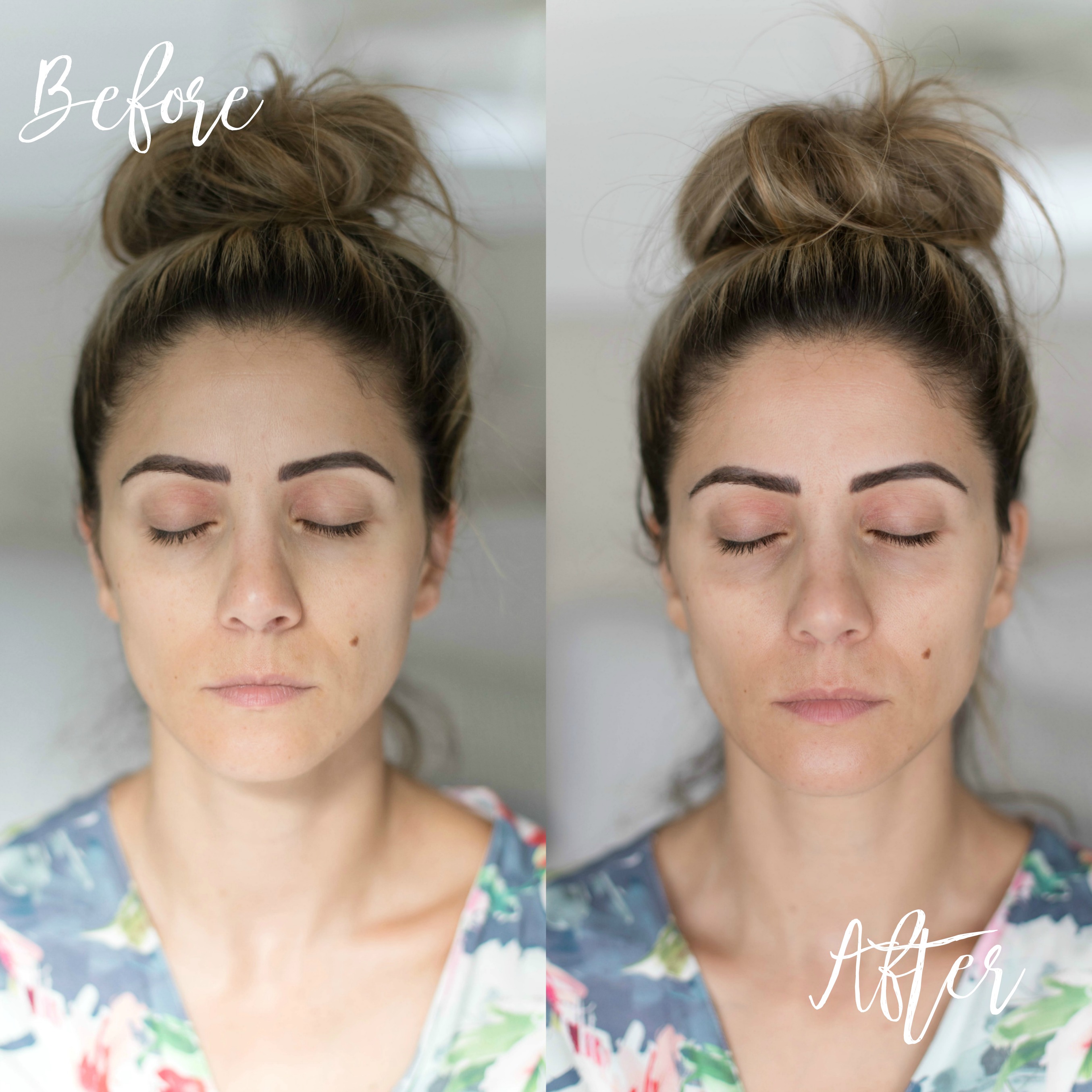 Connecticut life and style blogger Lauren McBride shares how to use the NuFACE FIX and benefits of microcurrent therapy.